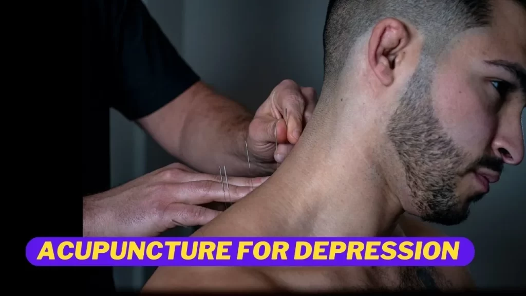 Acupuncture for depression