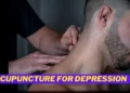 Acupuncture for depression