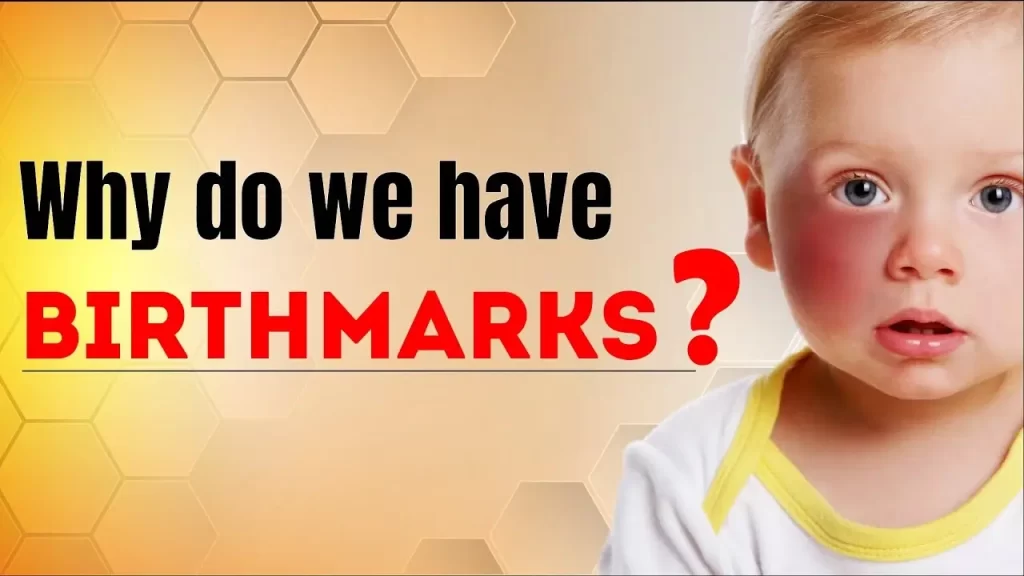 What is Psychic Birthmarks In Our Life